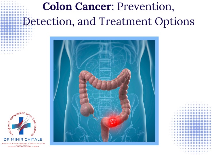colon Cancer: Prevention, Detection, and Treatment Options
