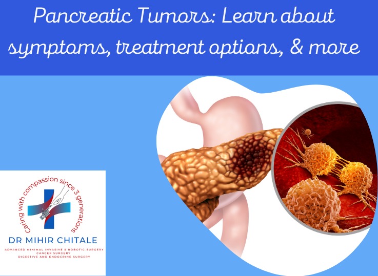 Pancreatic Tumors: Learn about symptoms, treatment options, & more.