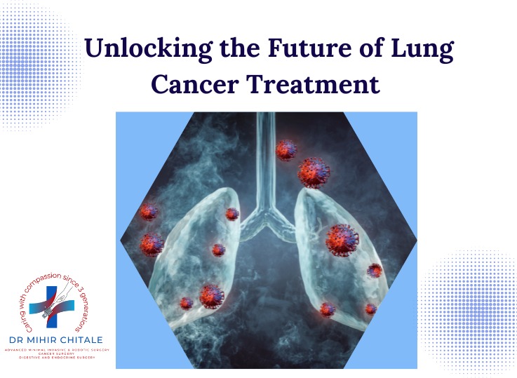 Lung Cancer Treatment: The Benefits of Thoracoscopic Surgery
