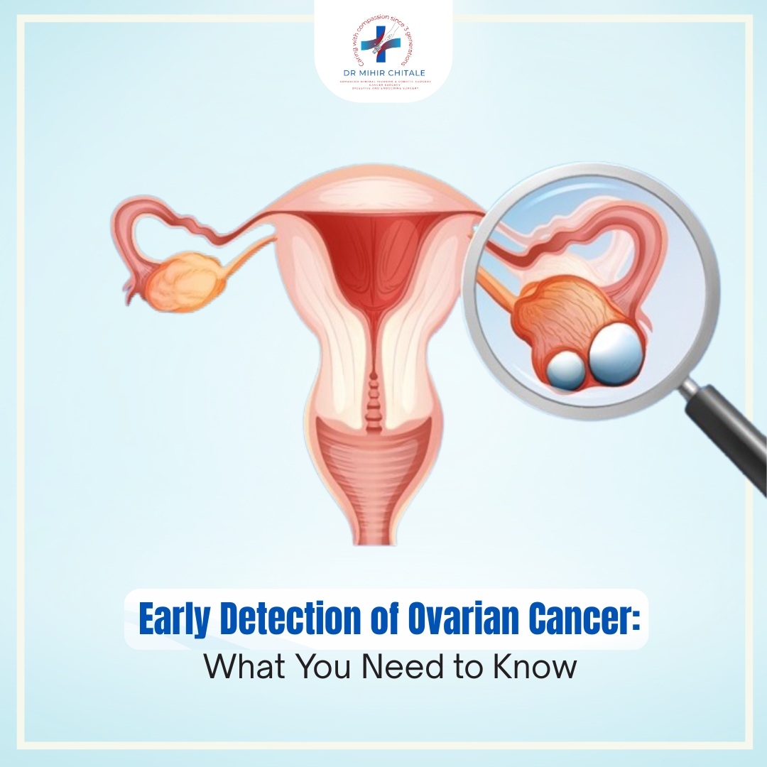 How to detect Ovarian cancer Early.?