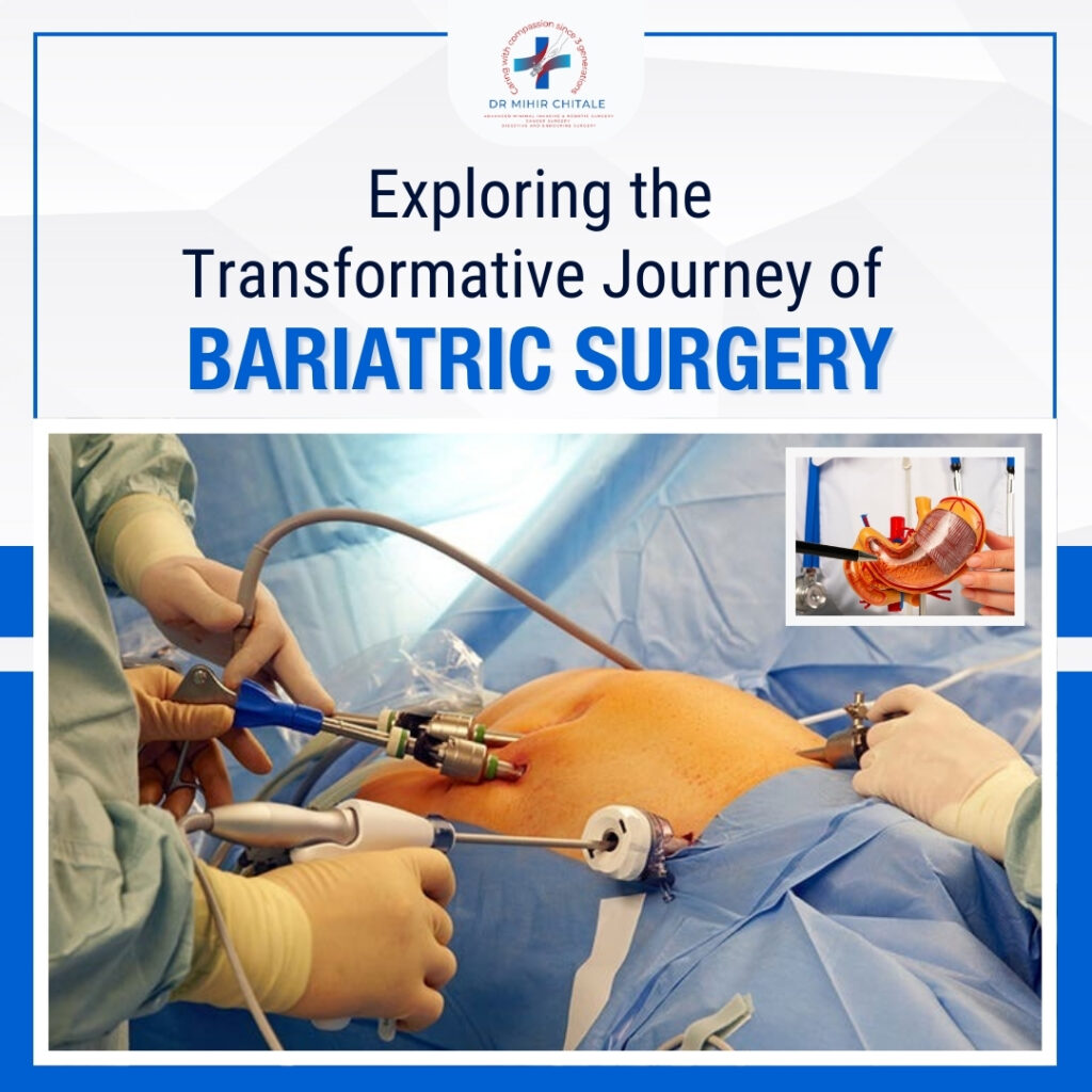 Exploring the Transformative Journey of Bariatric Surgery