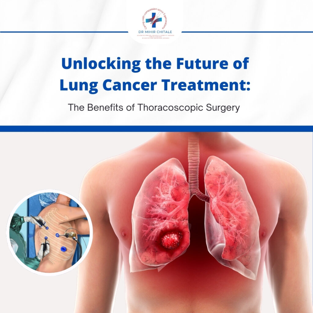 Unlocking the Future of Lung Cancer Treatment: The Benefits of Thoracoscopic Surgery