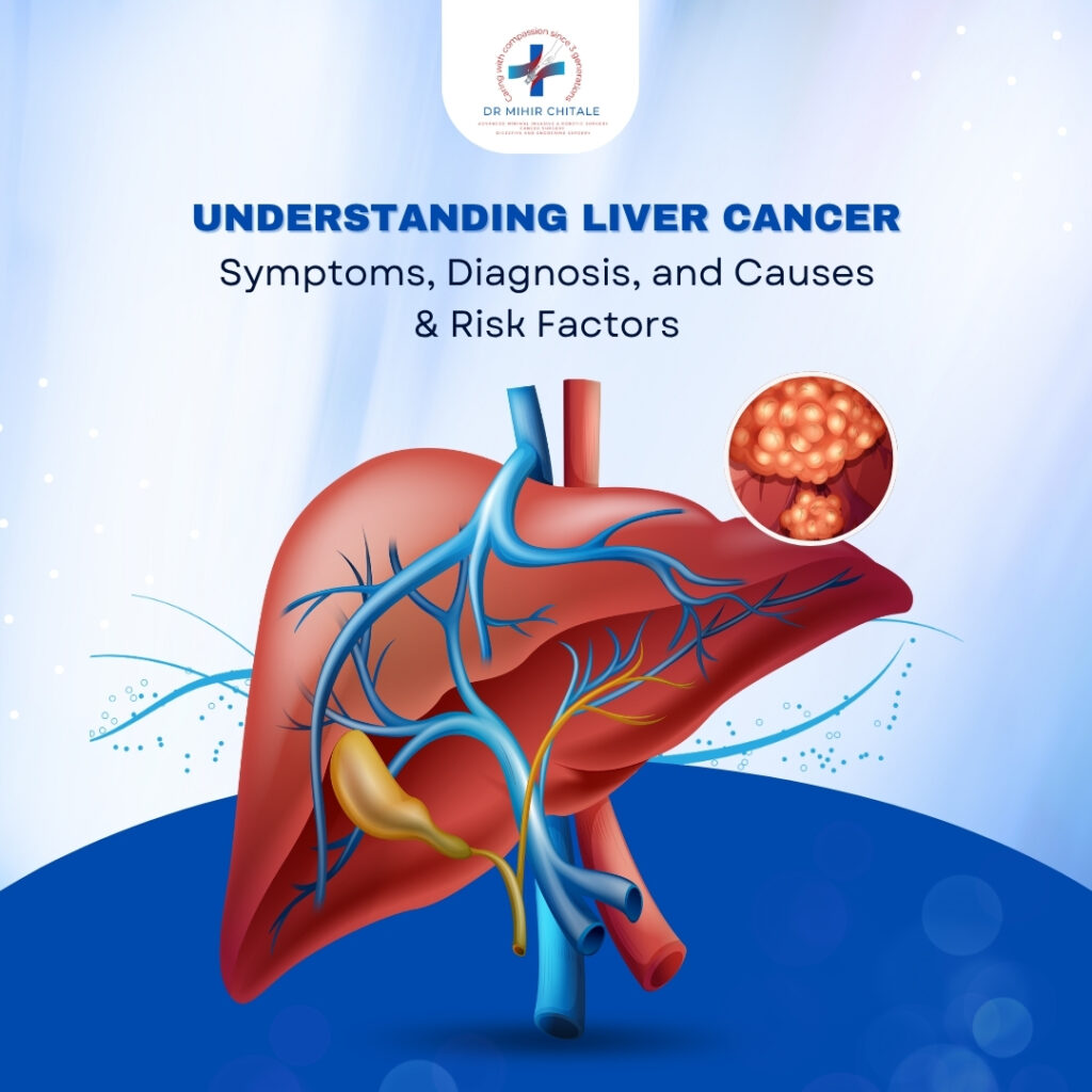Understanding Liver Cancer: Symptoms, Diagnosis, and Causes & Risk Factors