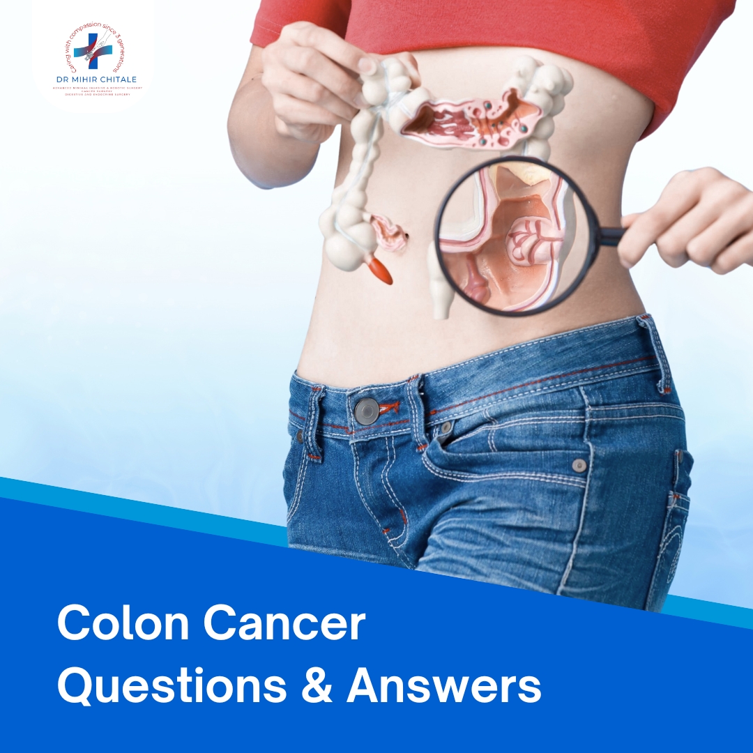 Colon Cancer Questions & Answers