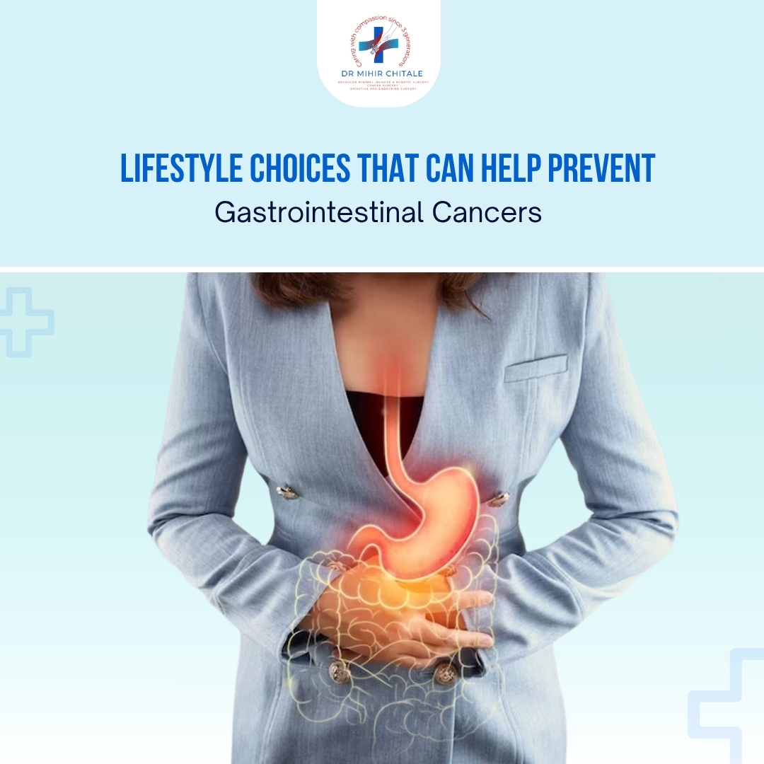 Lifestyle Choices That Can Help Prevent Gastrointestinal Cancers