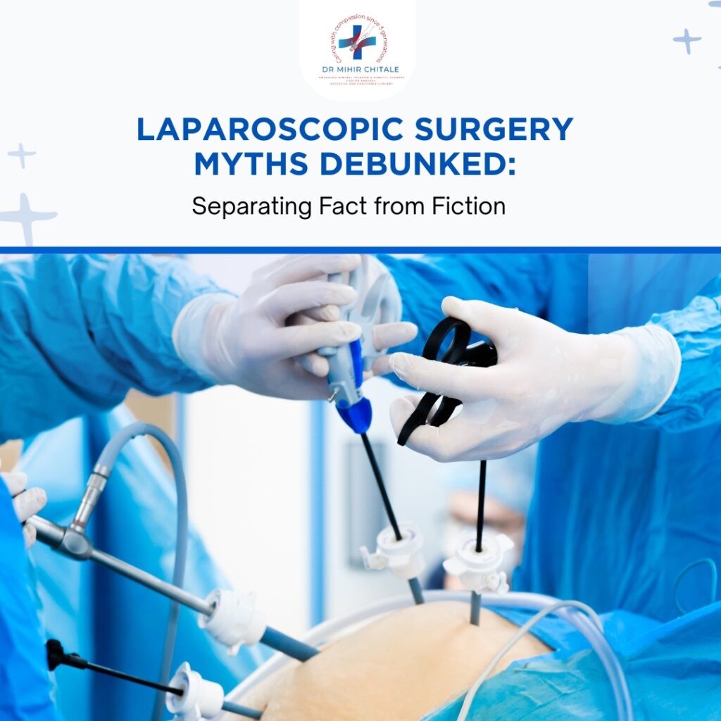 Laparoscopic Surgery Myths Debunked: Separating Fact from Fiction