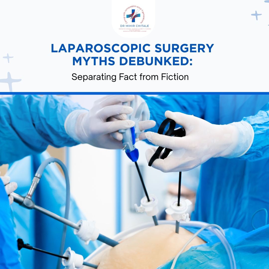 Laparoscopic Surgery Myths Debunked: Separating Fact from Fiction